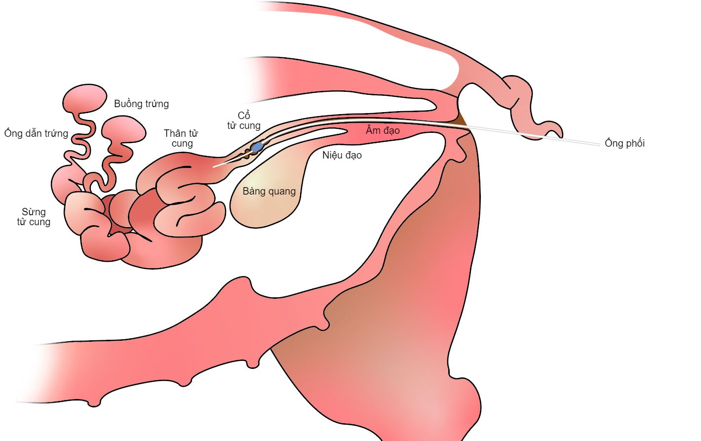 Que phối sâu cho lợn – Giải pháp nâng cao hiệu quả thụ tinh nhân tạo trong chăn nuôi heo